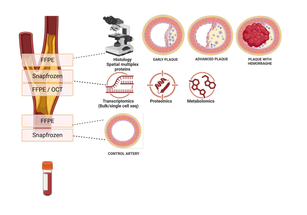 Table 3: General setup of AtheroMaas