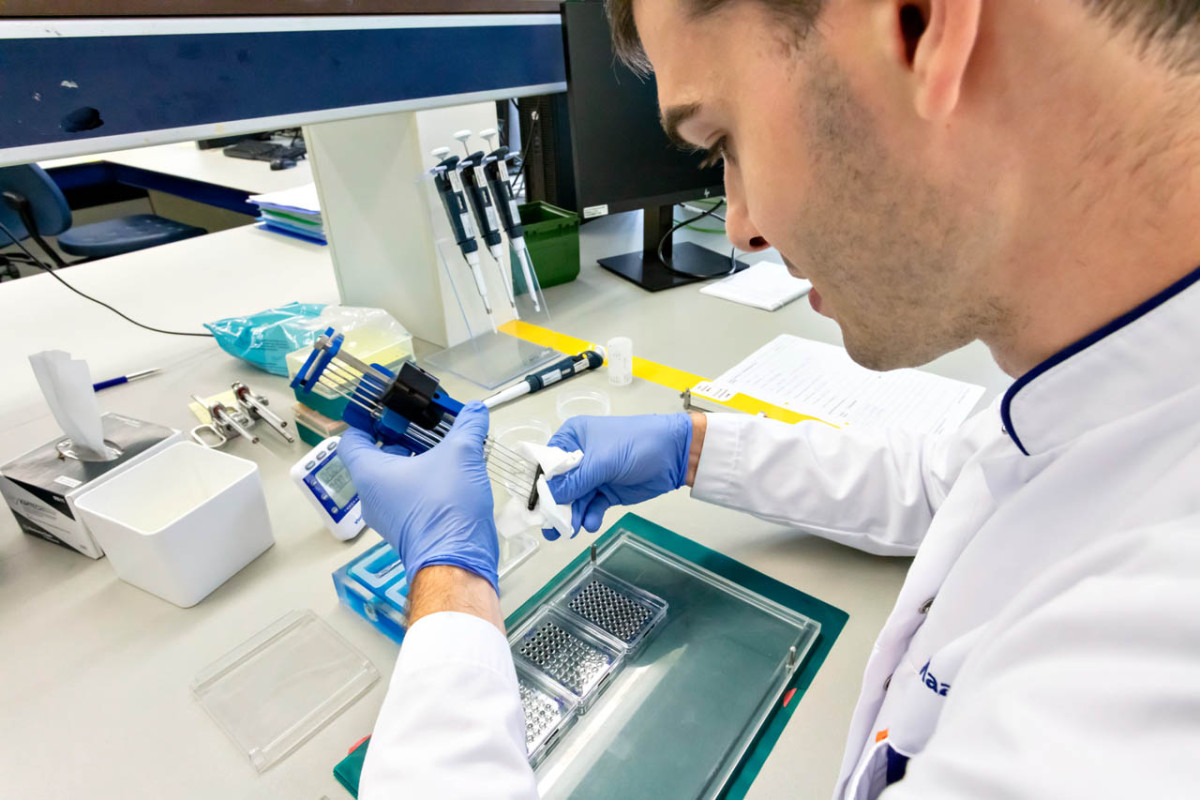 Transplantatie immunologie